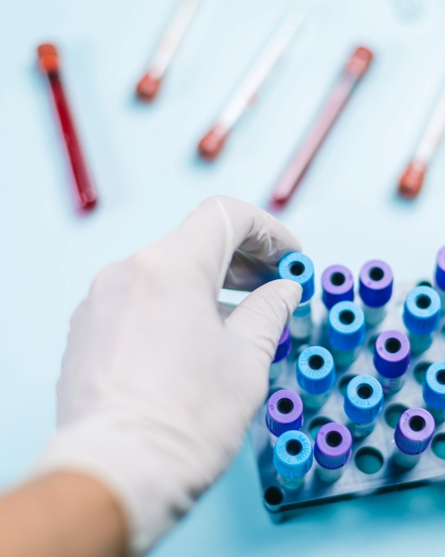 biotech drug development support